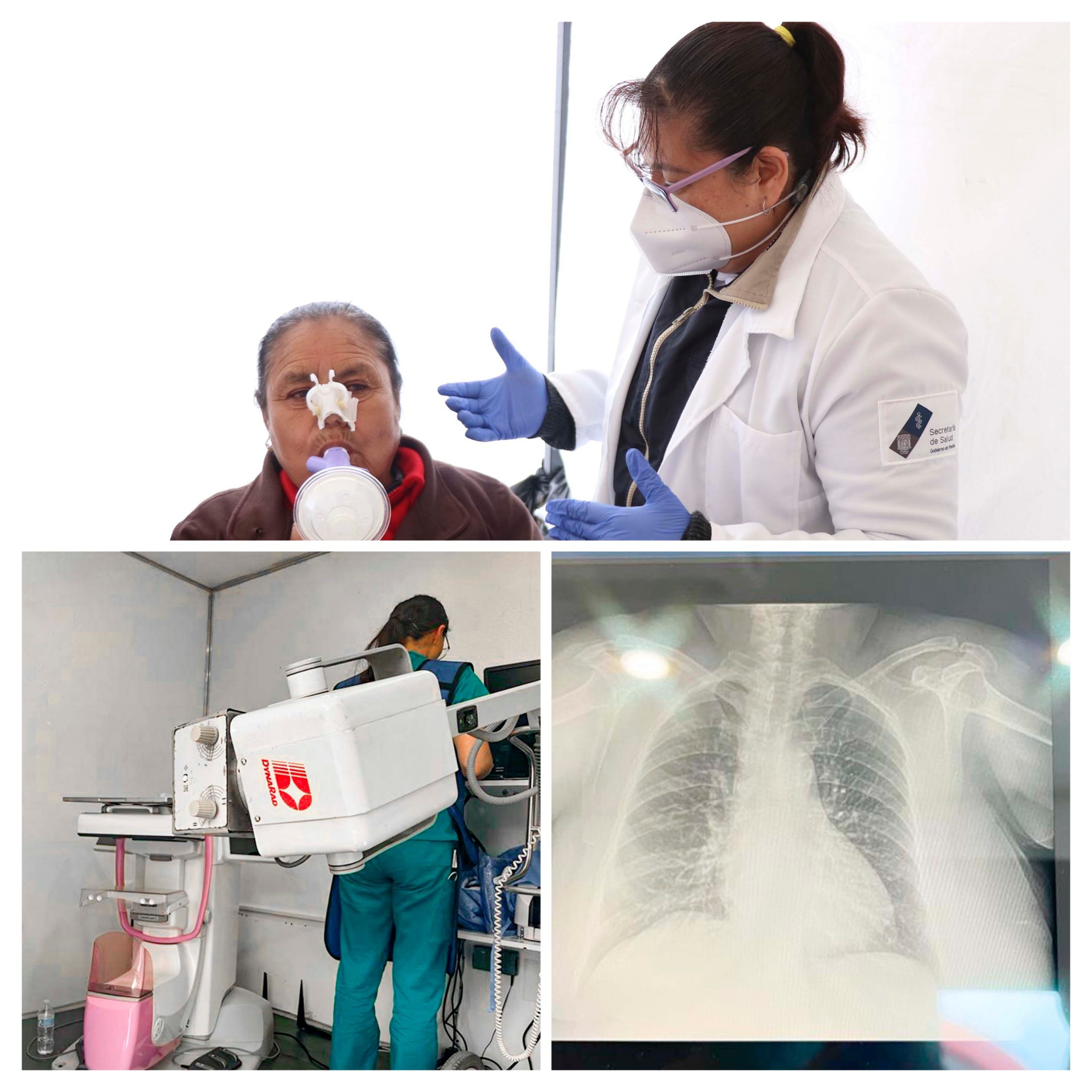 Inicia secretaria de Salud y la BUAP investigación para detectar afecciones crónicas en vías respiratorias, por caída de ceniza