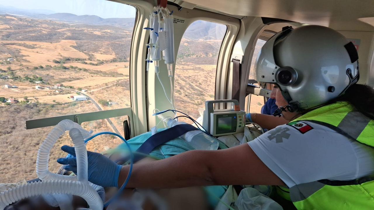 Trasladan vía aérea a paciente con quemaduras de Chiautla de Tapia a Puebla Trasladan vía aérea a paciente con quemaduras de Chiautla de Tapia a Puebla